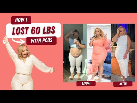 My 60 Pound PCOS Weight Loss Journey | Before and After [Video]