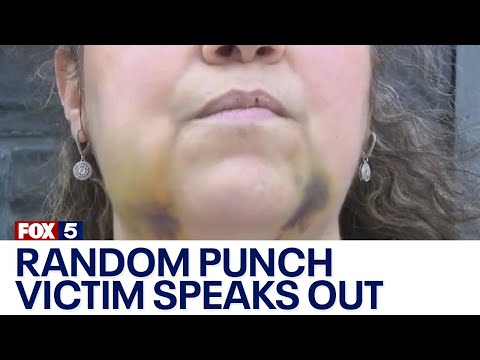 Victim of random punch attack speaks out [Video]