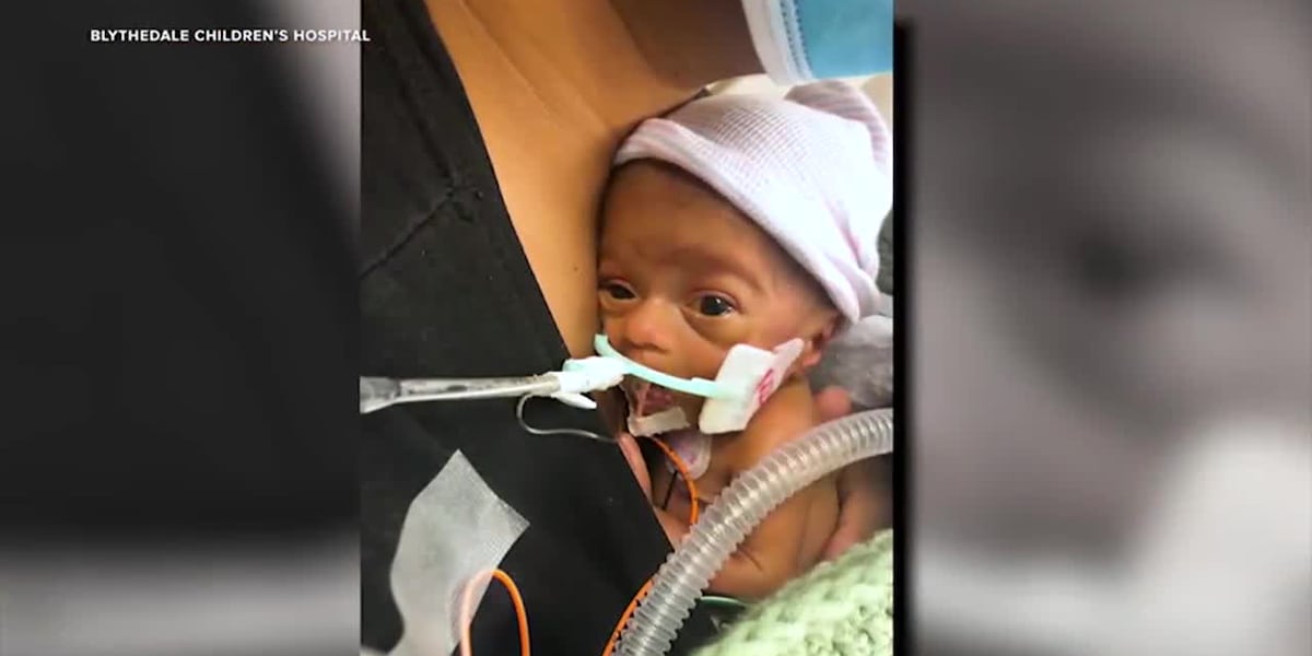 Parents of boy born prematurely bring him home from hospital after nearly 2 years [Video]